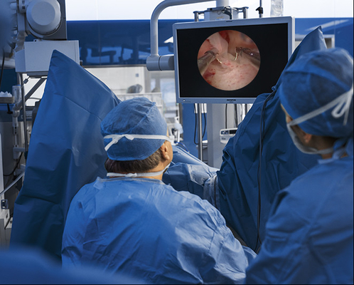Equipo favorable de Hysteroscopy de ginecología para los pólipos endometriales, la mioma submucous, las adherencias intrauterinas etc.