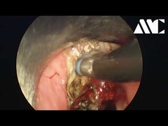 El contenido de nitrato de sodio