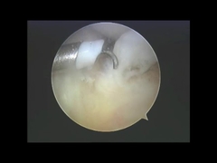 Las demás sustancias