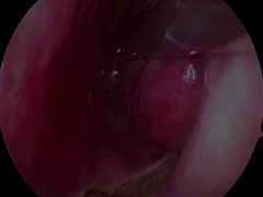 Proba de neurología ultrapequeña y flexible desechable PLA407