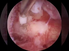 Las demás sustancias